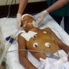 Syndrome de Lazare : ces morts qui “reviennent” à la vie, le phénomène médical qui trouble les scientifiques 