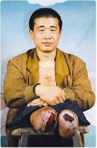 Sujiatun : la conscience à l'épreuve