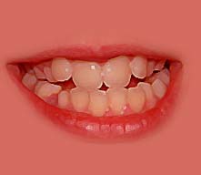 Un amour dévorant .Une nouvelle de Bertrand Betsch