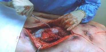 VOYAGE D'UN VIVANT PARMI LES MORTS