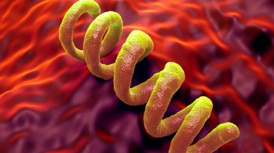 Retour de la syphilis : symptômes, causes, traitement et prévention d'une maladie en forte recrudescence