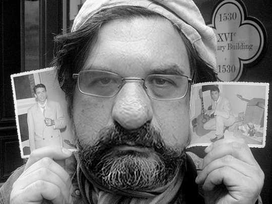 Conséquences du dopage : Edouardo victime d'une terrible maladie